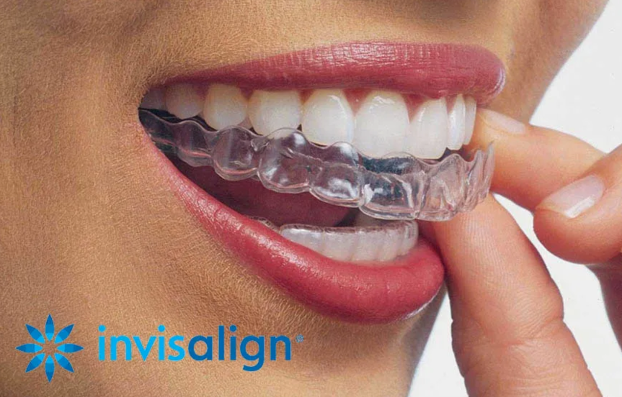 , Why More Adults Are Choosing Invisalign Over Traditional Braces