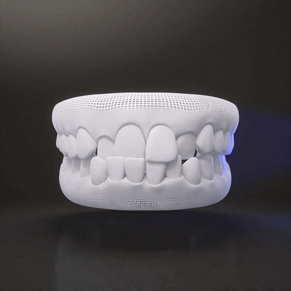 Virtual Scan Invisalign Aligners Edgware North London